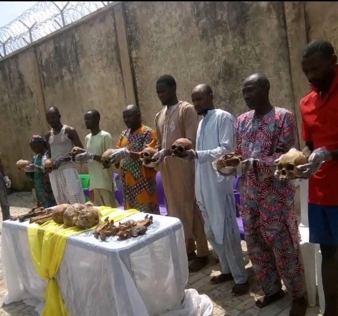 Emmanuel1761784's tweet photo. The yarigba skullpiad winners https://t.co/oJ0gEF9zpI