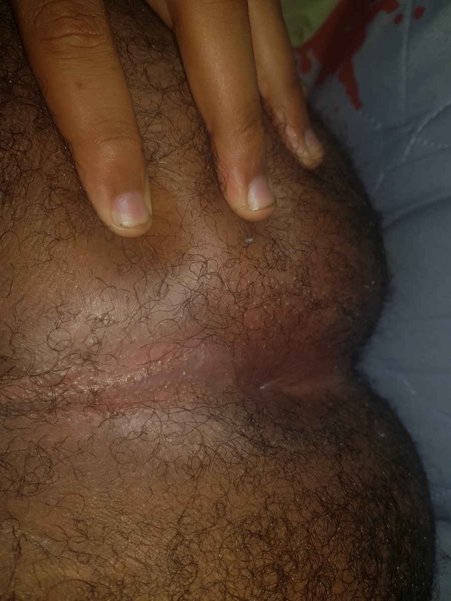 tighttgrip's tweet photo. Well tight https://t.co/TMAZb1Y08P