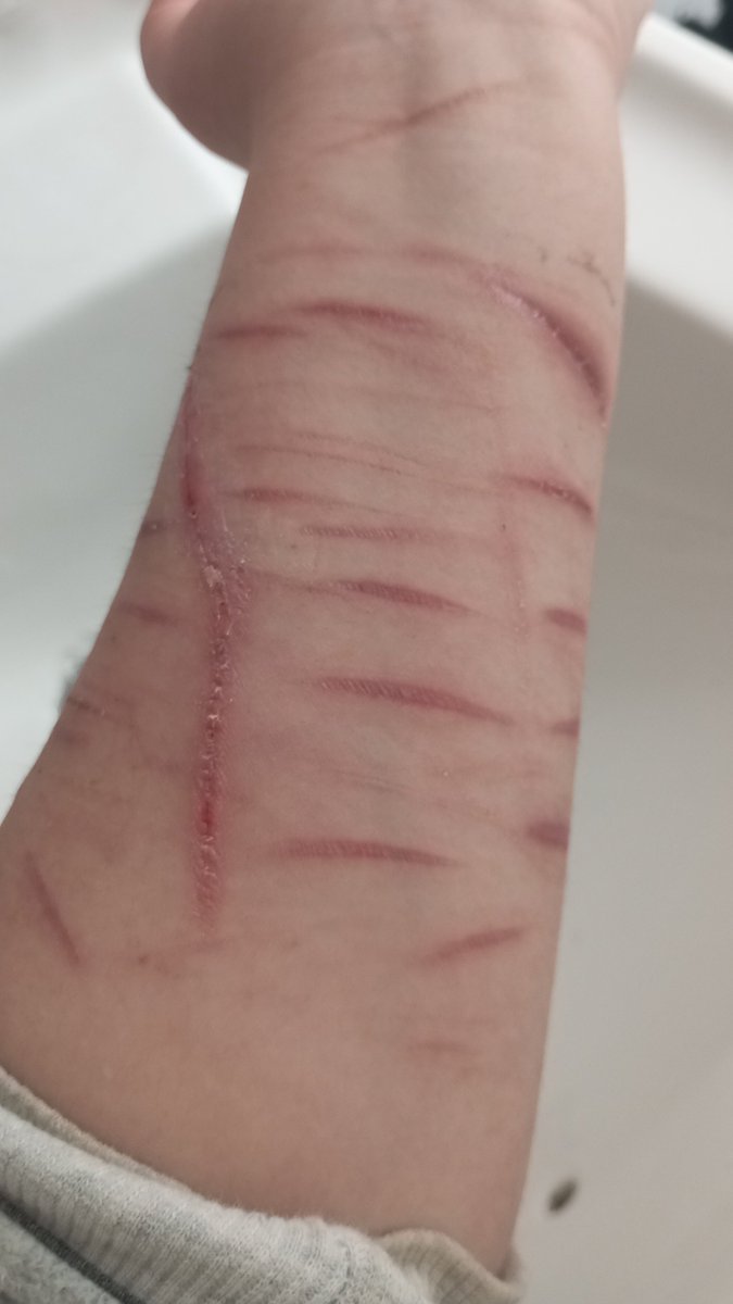 Kittehattakawa's tweet photo. Scarspo Owo

★How can I cover scars in summer ꒰ '' - 3- ꒱ᩙ?

#Suicidetwt #shtwt #988twt https://t.co/HqjgRpRGjr
