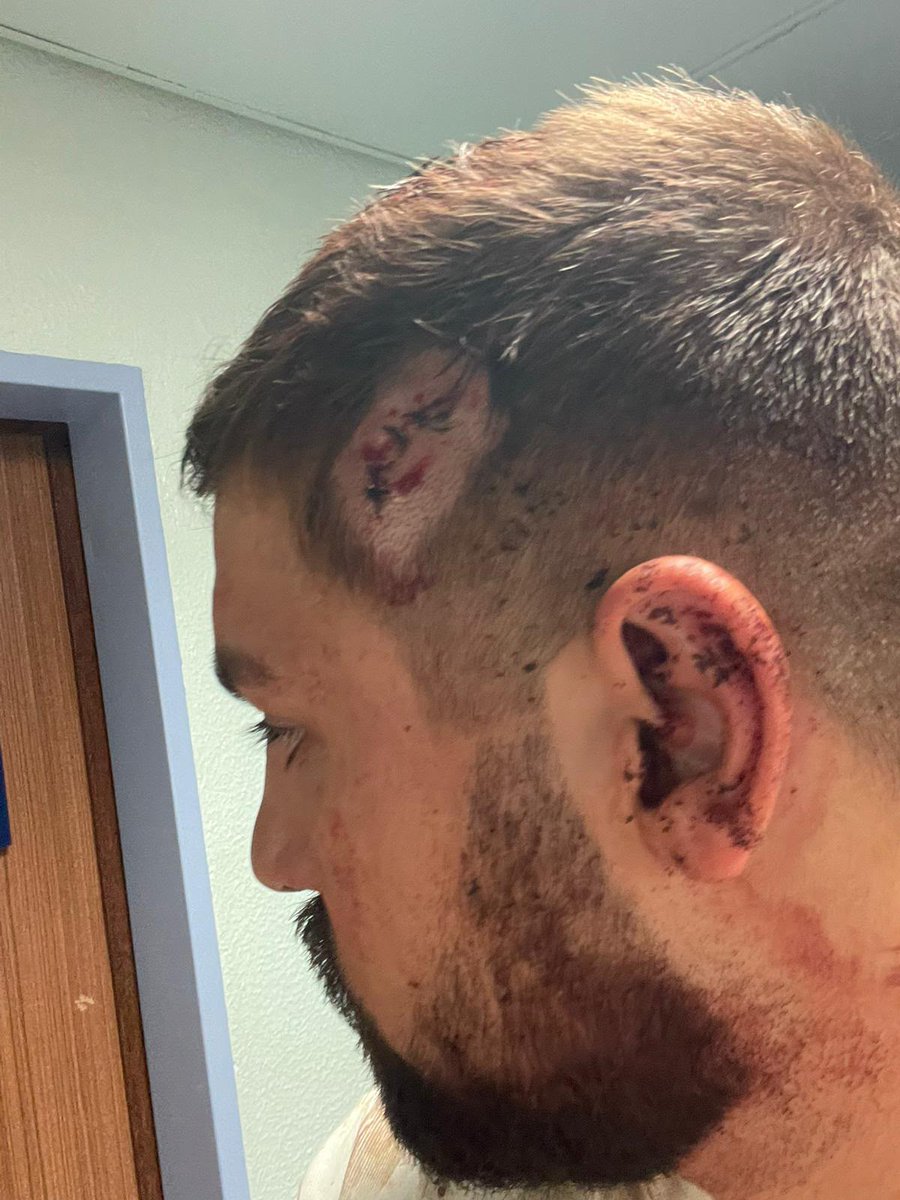 AndreCVentura's tweet photo. Um grupo de ciganos estava (como habitualmente) a criar desacatos num quiosque em Évora. Um militar da GNR tentou intervir para ajudar a proprietária e este foi o resultado! Até quando vamos continuar a ser tolerantes a esta violência sistemática??? https://t.co/DCJUxQTx35
