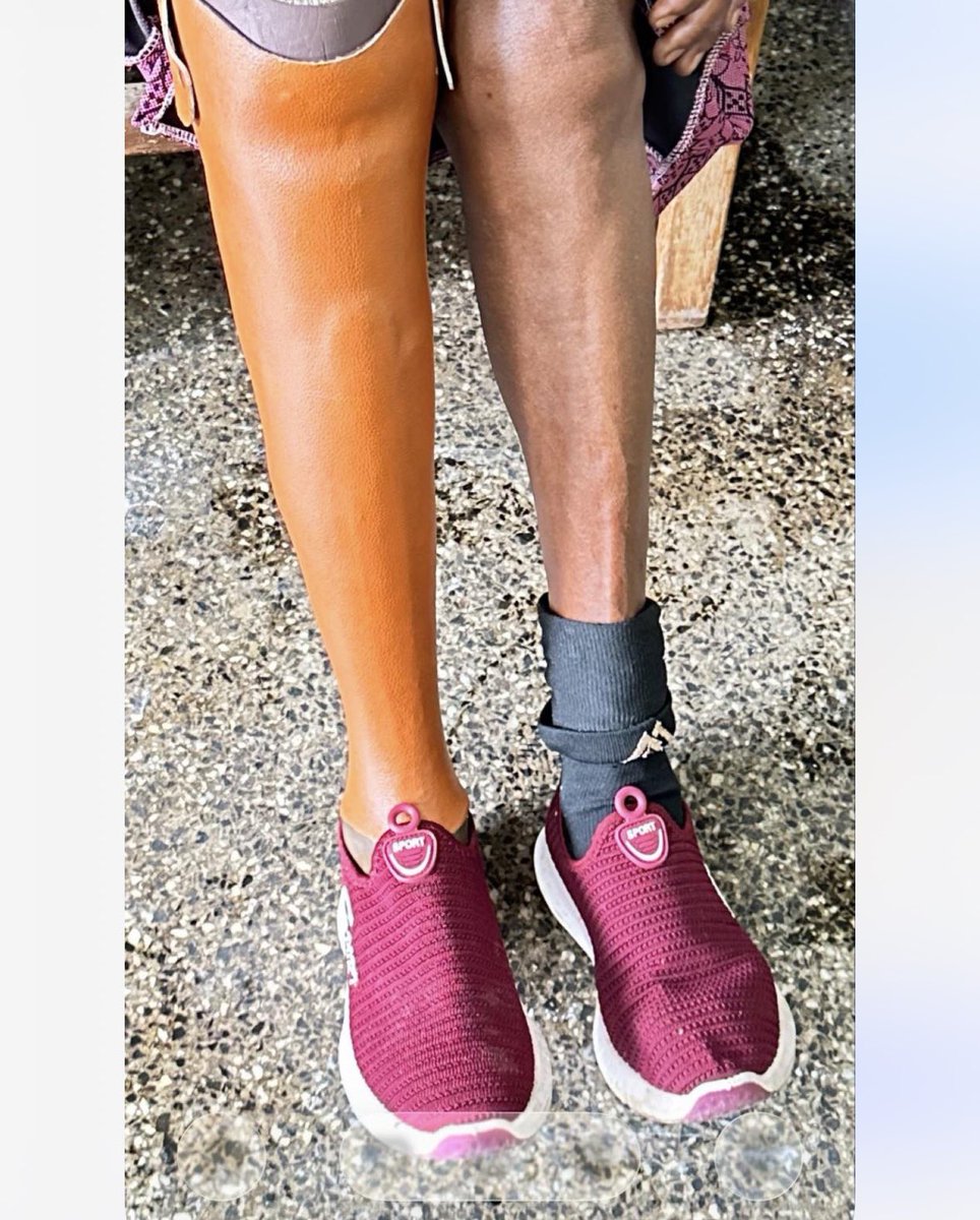 RanaLeteiyo's tweet photo. Below knee prosthesis is an artificial limb that is prescribed to a patient who has been amputated below the knee. Book your assessment and measurements with a prosthetist for quality and best fitting artificial leg. https://t.co/l8S28ICaM3