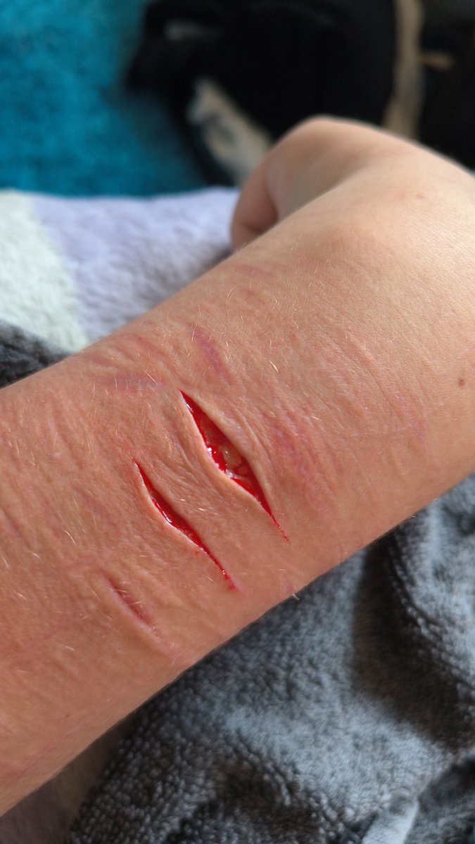 Amora744777's tweet photo. 1 SWIPE BEANS WITH A PENCIL SHARPENER BEFORE SCHOOL??? I'M SO COOKED OMG ai not real sfx  makeup
.
.
#shtwt #slitwt #beans #styro #bbeans #sledtwt #988twt #gore #goretwt https://t.co/JPpdICmlIP
