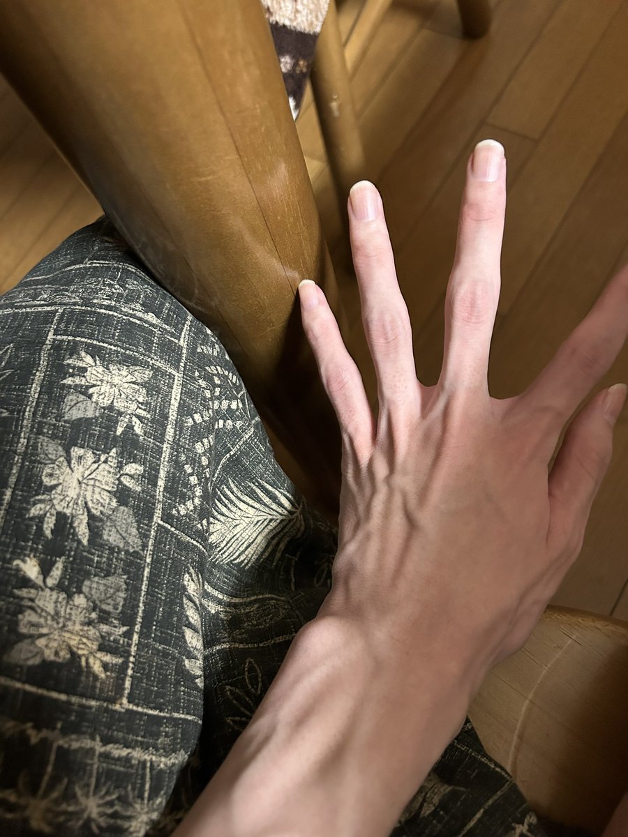 Like_leica's tweet photo. 血流回りすぎて、手足血管おばけなんだけど https://t.co/klCGrgfCYj
