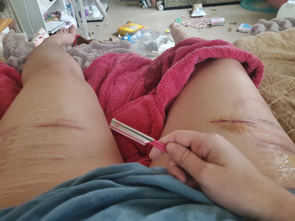 SOSbliss's tweet photo. I actually really don't wanna do it at the same time like... am I a coward or do I actually wanna recover? But the urge to cut is also so strong... https://t.co/vuJdLA7XYS