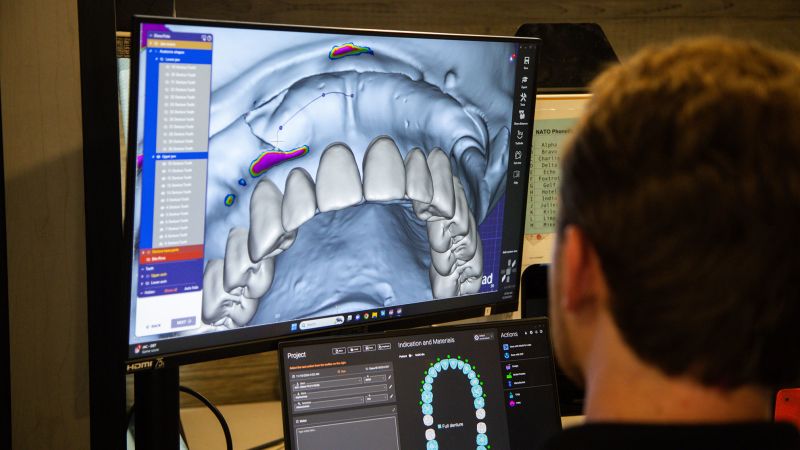 MikeBriddon's tweet photo. Thousands of people are seeking help from a 22-year-old man who provides #dentures to those in need. A recent CNN article, which includes CareQuest Institute research, spotlights his work to help people access affordable dental care: https://t.co/RvXLxLzP2g https://t.co/lRNn59eFs6