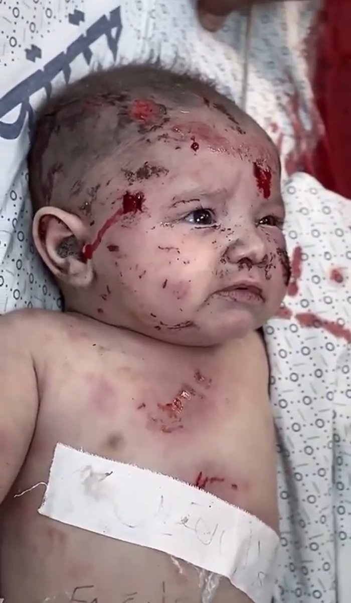 Ros10101's tweet photo. Bu fotoğraf yüreğimi parçaladı 💔 https://t.co/Gs8UpBstpS