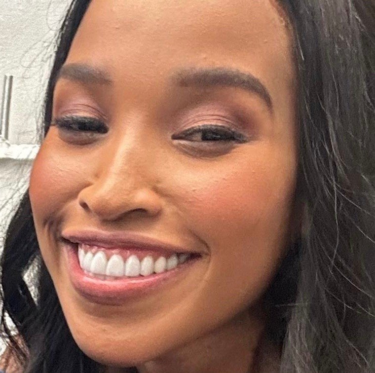 dontdorh's tweet photo. Bongani Zungu has STDs that goes back to his prime and peak from all the girls he slept with then you get desperate Cindy Mahlangu who had to settle with his dry ashy mphatshampatsha phuza face shame. Bongani , the stallion, free for all dick Zungu &amp; Cindy pill popper Mahlangu! https://t.co/XYgQOvjEZY