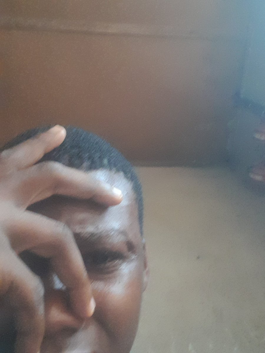 boy55878's tweet photo. I failed again 💔😭

Blew my 2 first ever funded prop accounts without no single payout. 

Is trading actually for me ?

It hurts 😭😭💔💔

Where &amp; how do I even start again ?😔🥺
@Khldfx @DumbMoneyHunter @avikkfp @EdwardXLreal @atlasfunded @Techriztm @Kelvintalent_ @Fznation01 https://t.co/9ChveBsCVc