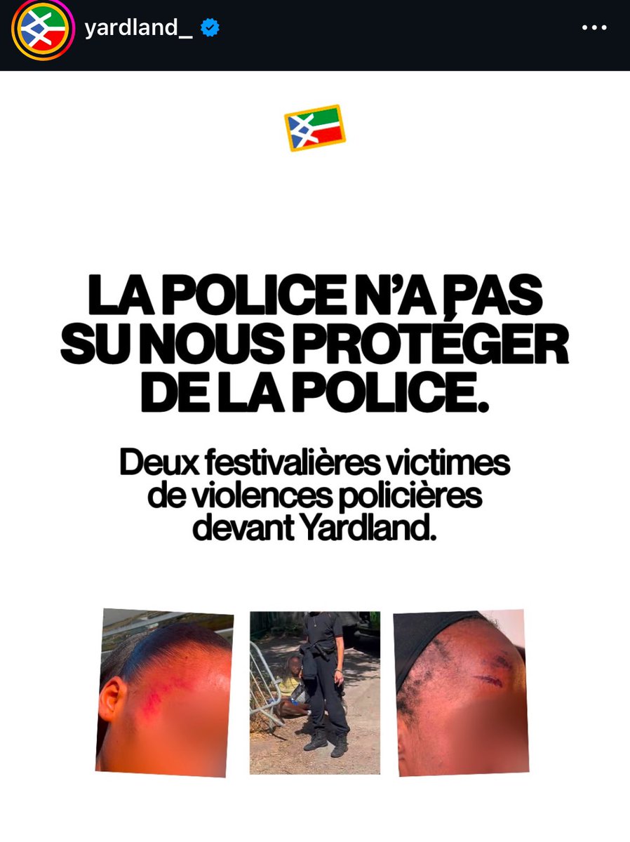 OuiCerCelia's tweet photo. Deux jeunes femmes Noires ont été agressées par la police à l’entrée de YardLand dimanche : violences physiques/verbales, ongles/cheveux arrachés, humiliation et déni d’accès aux soins. Toute la force à elles deux mais qui va nous protéger de la police ? 

https://t.co/o3QutGOuaI https://t.co/kDAr3ZYqao