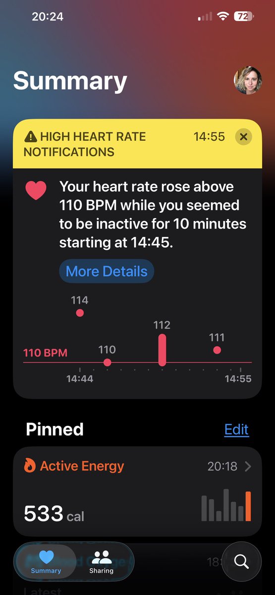 sarahnadav's tweet photo. It’s the end of day 17 on calcium channel blockers for coronary vasospasm and I think it’s time for me to say that this is WORKING for a lot more than chest pain. 

The good: 

My menstrual cycle is over and it was nothing. I didn’t have any cramps and didn’t end up in the ER which is a huge deal for me. Ladies- spread the word- calcium channel blockers stop uterine smooth muscle from cramping and is life changing. 

PEM is basically gone. If I push myself, I’m not paying the next day. I’m waking up with my best energy in the morning. 

My step count is up by A LOT and I’ve been swimming in the sea for 20 min twice this week. 

And despite CCBs being meant to lower blood pressure, mine is stable and fine even with POTS. 

The down: 

I’m getting high heart rate notifications while sitting. It’s not crazy high- but it’s not great.

My feet are red and swollen like watermelons. It’s hard to wear compression stockings in the summer but the edema is awful that I might have to. 

It’s still early days