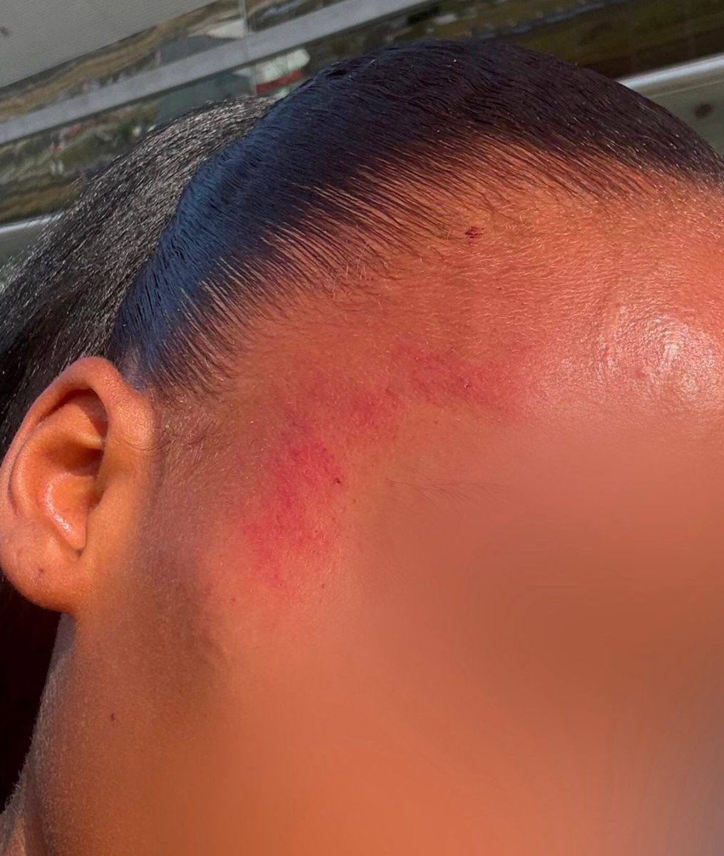 amin_snoussi's tweet photo. 🚨 Samedi dernier, deux femmes noires ont été violentées par des policiers à Yardland : L’une a été maintenue au sol par 4 agents alors qu’elle est asthmatique.. pour avoir tardé à descendre d’un VTC.

Hier, les députés votaient la loi de présomption de légitime défense aux FDO. https://t.co/X1BhSvDyhv