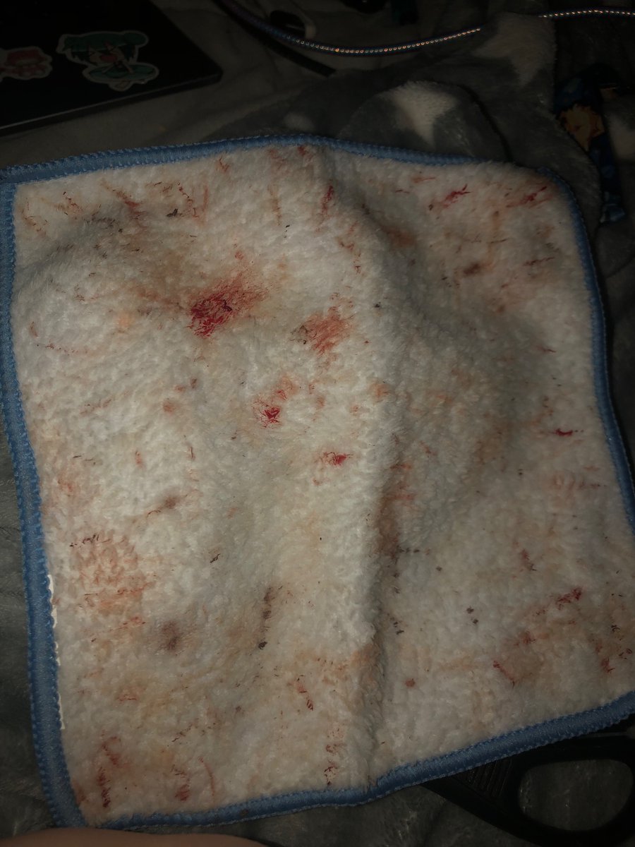 XianxiaX3's tweet photo. It actually wont stop bleeding like omg bro, also this blood rag is so absorbent bc look at the lack of blood on there (i admittedly spent 4 hours just hacking at this to make it like that, i wish i could one swipe)
ALL FAKE SFX MAKEUP NOT REAL
#slitwt #shedtwt #shtwt #sledtwt https://t.co/QzFC1FZl82