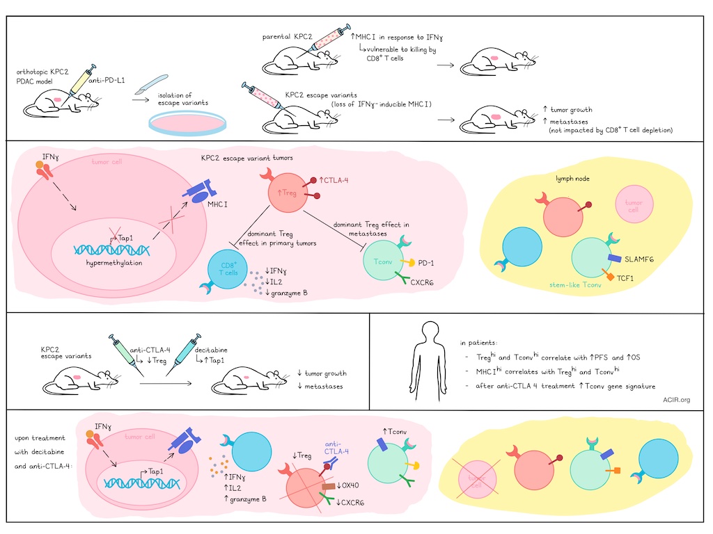 ACIR_org's tweet photo. Schmiechen et al. recently unraveled a complex web of escape mechanisms and immune interactions in pancreatic ductal adenocarcinoma. https://t.co/8dp5Ts6ary
@umnmedschool
@IngunnStromnes
Schmiechen et al. found that variants of PDAC that escaped following PD-L1 blockade showed epigenetic silencing of Tap1 expression, which induced loss of IFNγ-inducible MHC-I and reduced tumor cell killing mediated by CD8+ T cell. Escape variants also had an increased capacity for metastasis, which was promoted by Tregs and their suppressive effect on conventional CD4+ T cells. Combination strategies involving restoring IFNγ-inducible MHC-I, targeting Tregs, and enhancing Tconv enabled more effective cancer immunotherapy, suggesting potentially targetable mechanisms to enhance immunotherapy in PDAC.