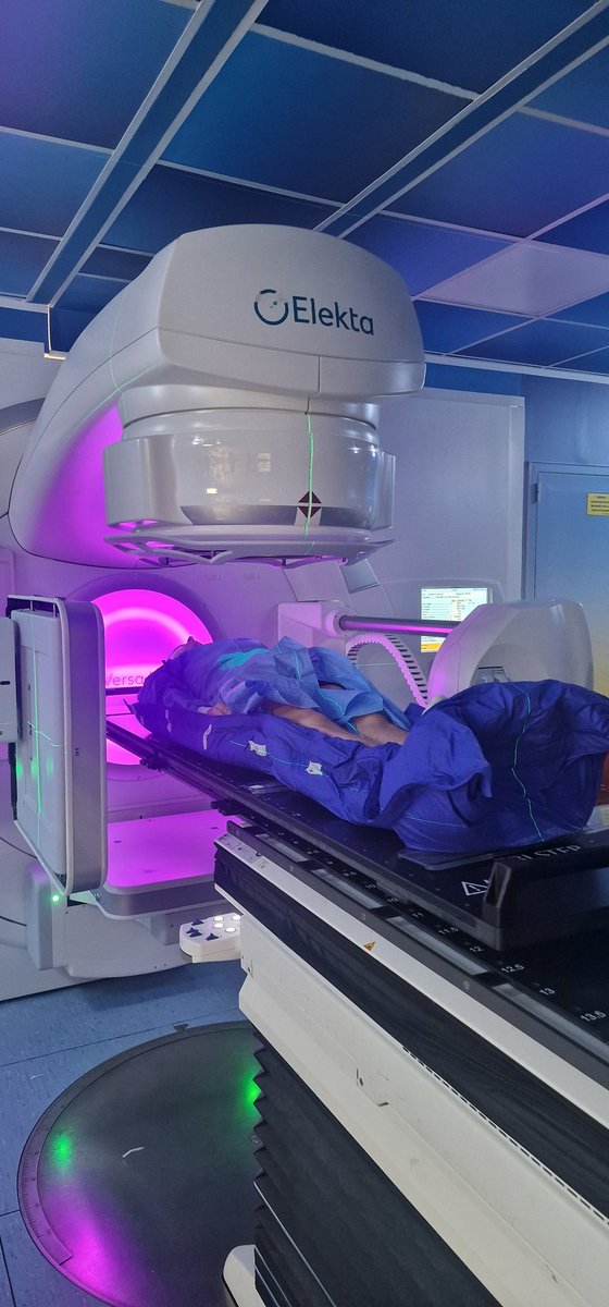 CTuscanoMD's tweet photo. Rotational table top for first Total Body Irradiation with VMAT at @GOM_rc as part of transplant conditioning in a adult with T-cell ALL. Mean Lung Dose < 8 Gy. Great effort by #radonc #medphys #RTT team. https://t.co/SlOkHozRLV