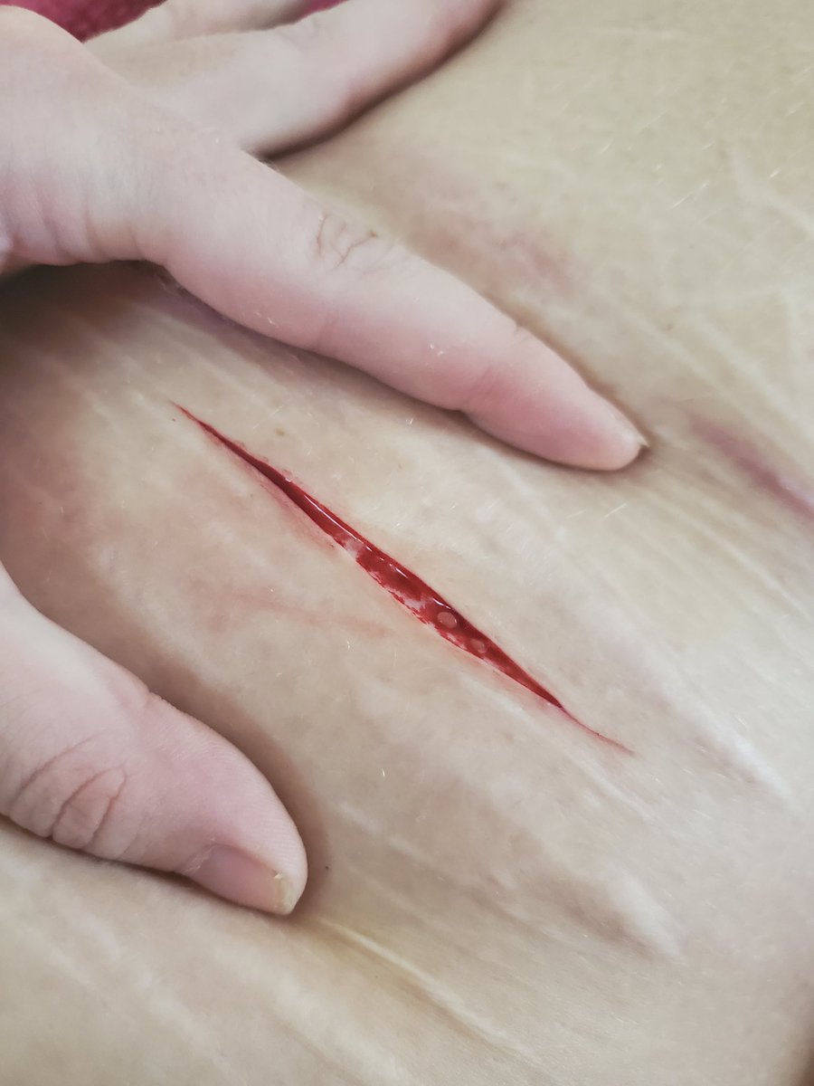 SOSbliss's tweet photo. Started with one-swipe bby beans
Ended here
My bandages are tine so I can't do long cuts rn...

#beanstwt https://t.co/AXCnIexsYs