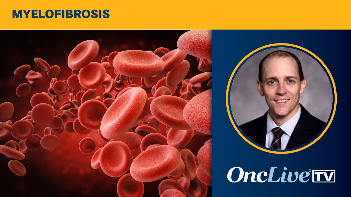 OncLive's tweet photo. Anemia remains one of the toughest challenges in myelofibrosis management. Anthony M. Hunter, MD, breaks down where luspatercept fits among other treatment options and how he approaches the decision for individual patients.
See more: https://t.co/wjEX2RCFoL
#Myelofibrosis #MPNs #Luspatercept