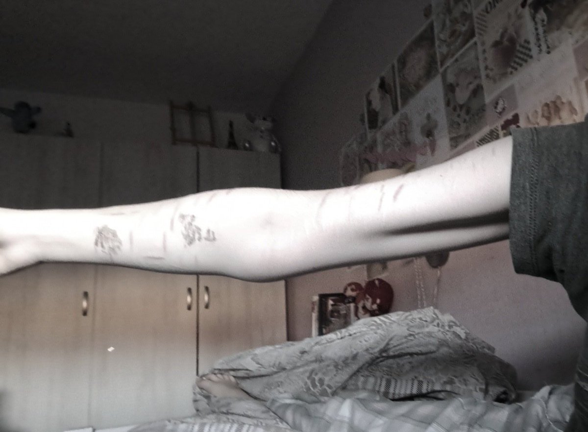 lucsdearest's tweet photo. Aughh u cnt see it but my arm is covered in red spots , it looks dirty https://t.co/QK4V16eaqm