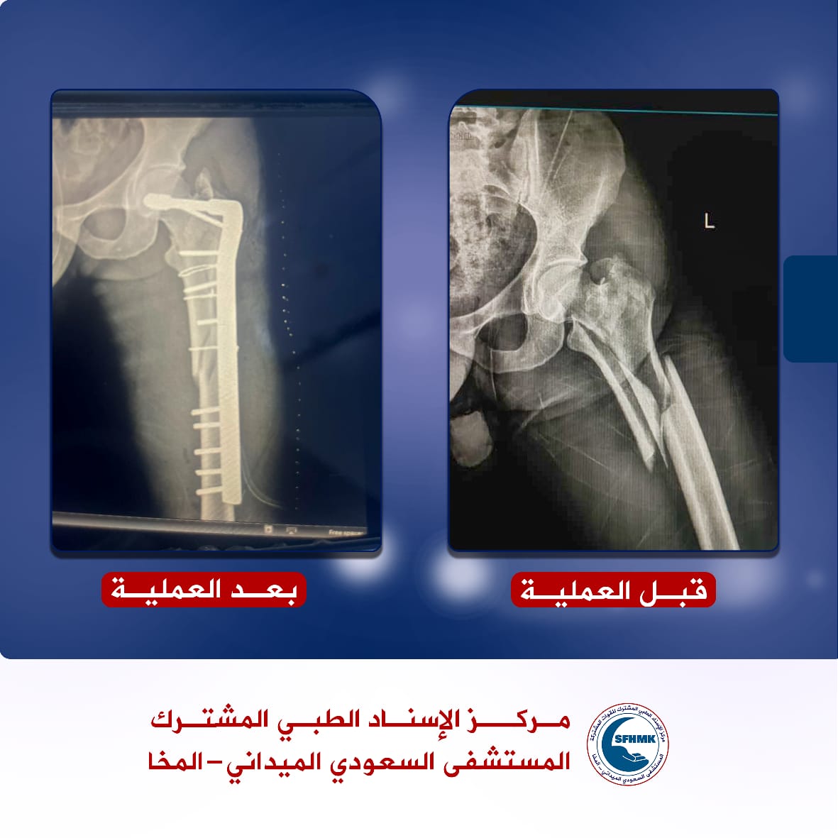 AltbyaService's tweet photo. #المستشفى_السعودي_الميداني_المخا https://t.co/00GVyQiSUD