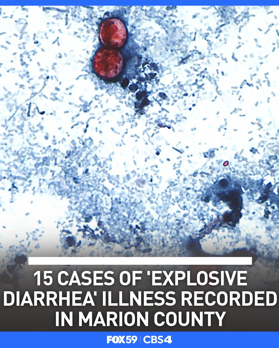 FOX59's tweet photo. NEW: A parasitic illness that reportedly causes “explosive” diarrhea has now reached central Indiana after spreading through over a dozen nearby states. https://t.co/LJyA0IwFWu https://t.co/cyKL5ujJoi