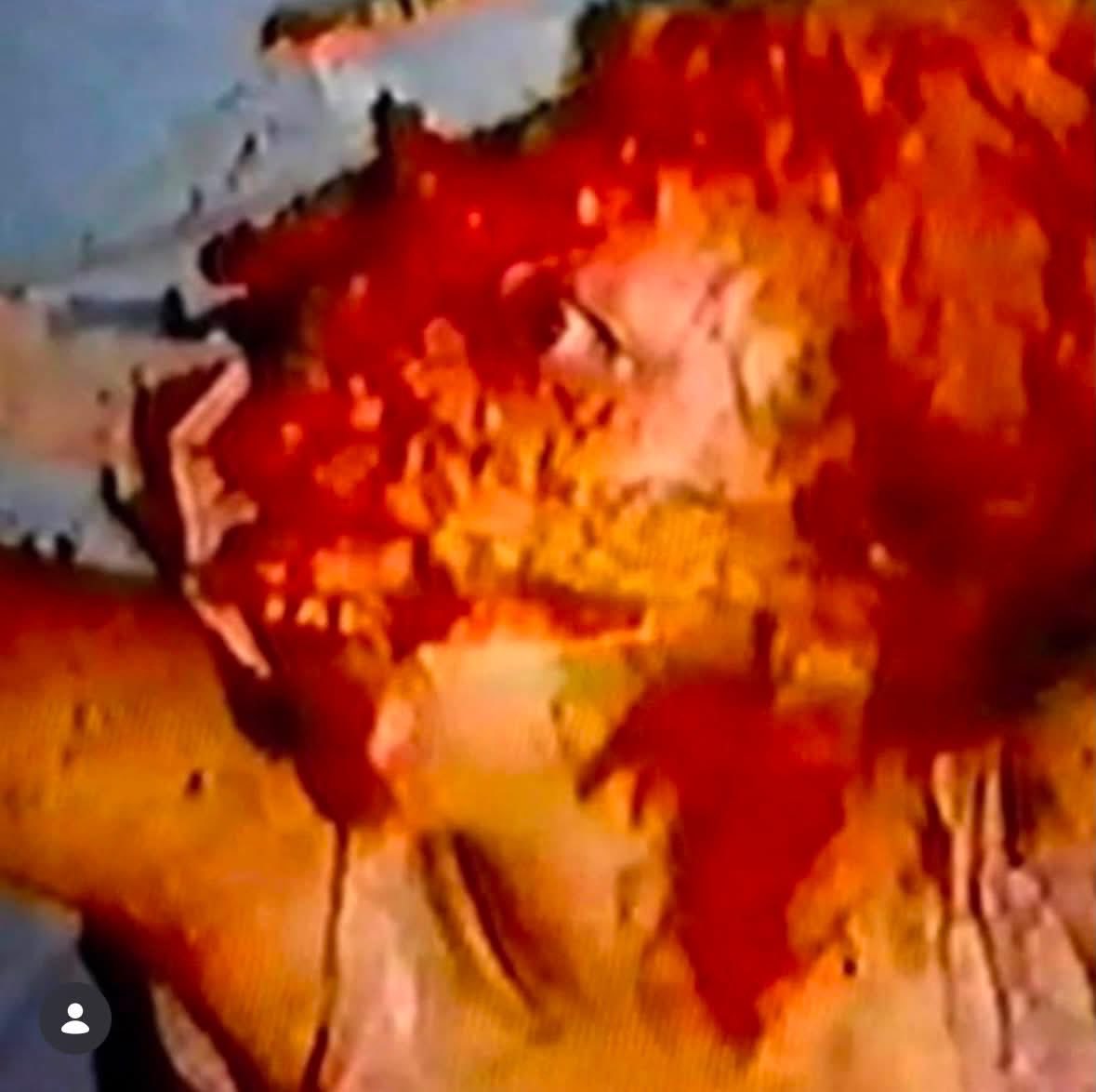 Jfree75's tweet photo. THIS IS THE FACE OF A YOUNG GIRL HILLARY CLINTON AND HUMA ABEDIN TORTURED AND SACRIFICED FOR ADRENOCHROME. THE FULL VIDEO WAS FOUND ON CONGRESSMAN ANTHONY WEINERS LAPTOP THAT WAS SEIZED BY THE FBI. GO RESEARCH FRAZZLEDRIP FOR ALL YOU NEWBIES JUST WAKING UP!!!!
#FRAZZLEDRIP https://t.co/woR5moq6yR