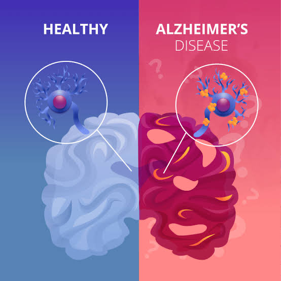 AlexandraS35848's tweet photo. Alzheimer's is kicking in 😜 https://t.co/TZ3fdWhgII