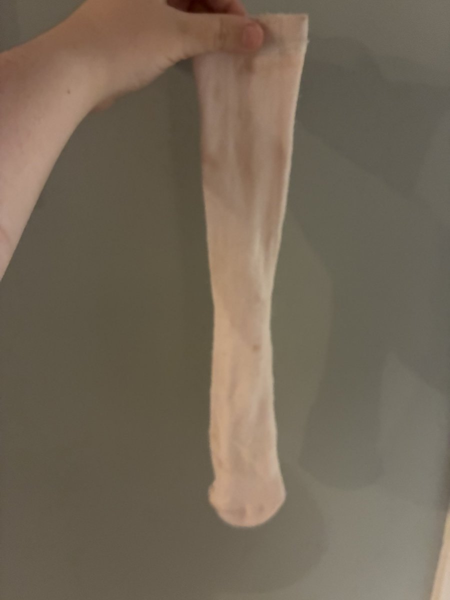 callmecutson's tweet photo. blood sock before and after bath https://t.co/ykAddLUO4e