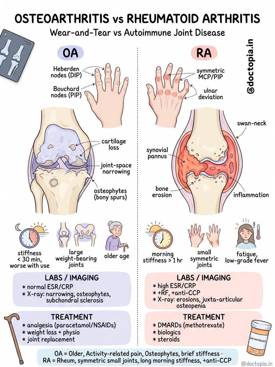 VitalViz's tweet photo. Osteoarthritis v/s Rheumatoid Arthritis . https://t.co/ZHq61dei9B