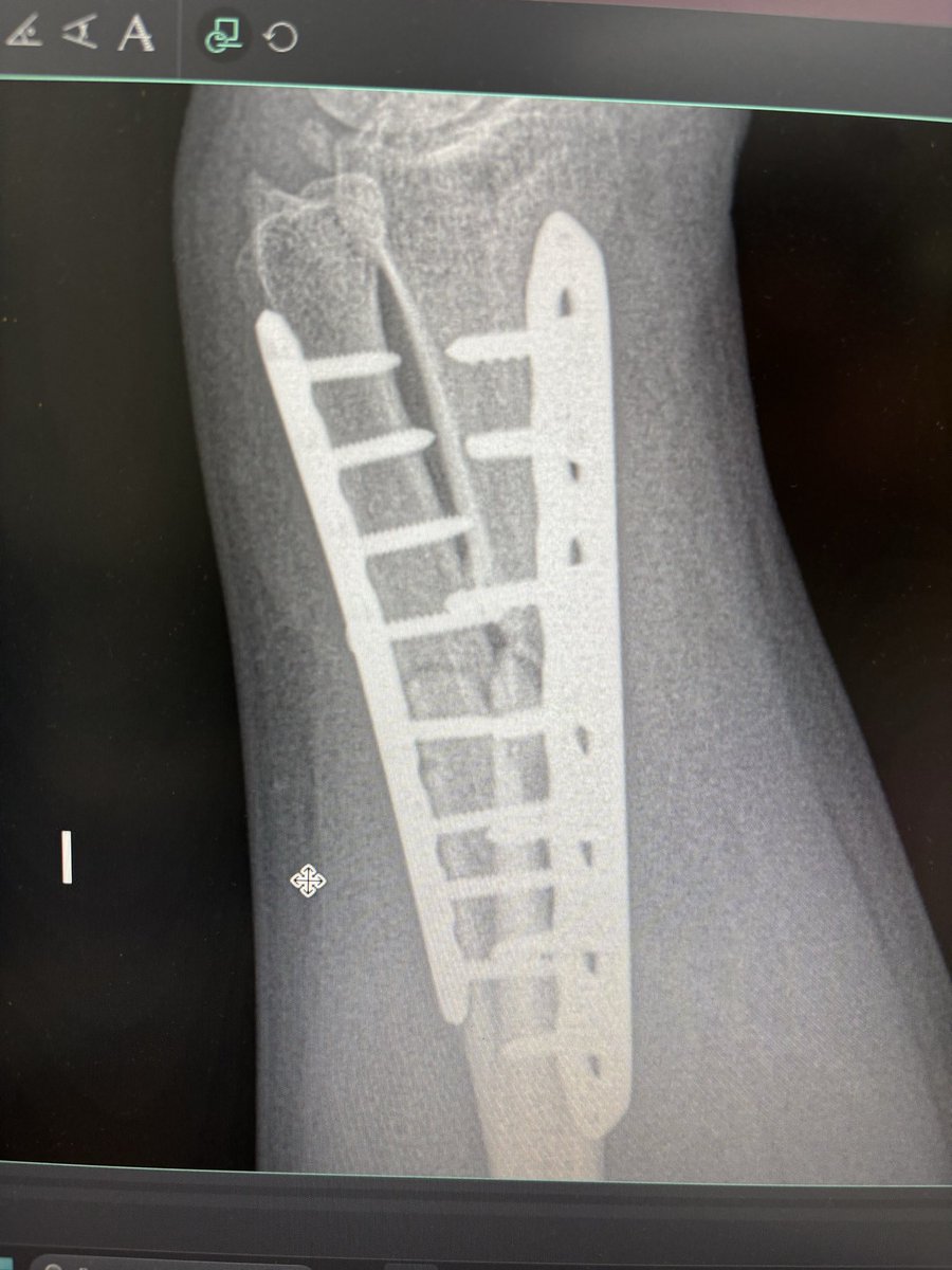 pekerocker20101's tweet photo. @alfredovlza Por qué ocuparía para mi medicamento  por qué la post cirugía dueleeee https://t.co/GJhYE8RfNT