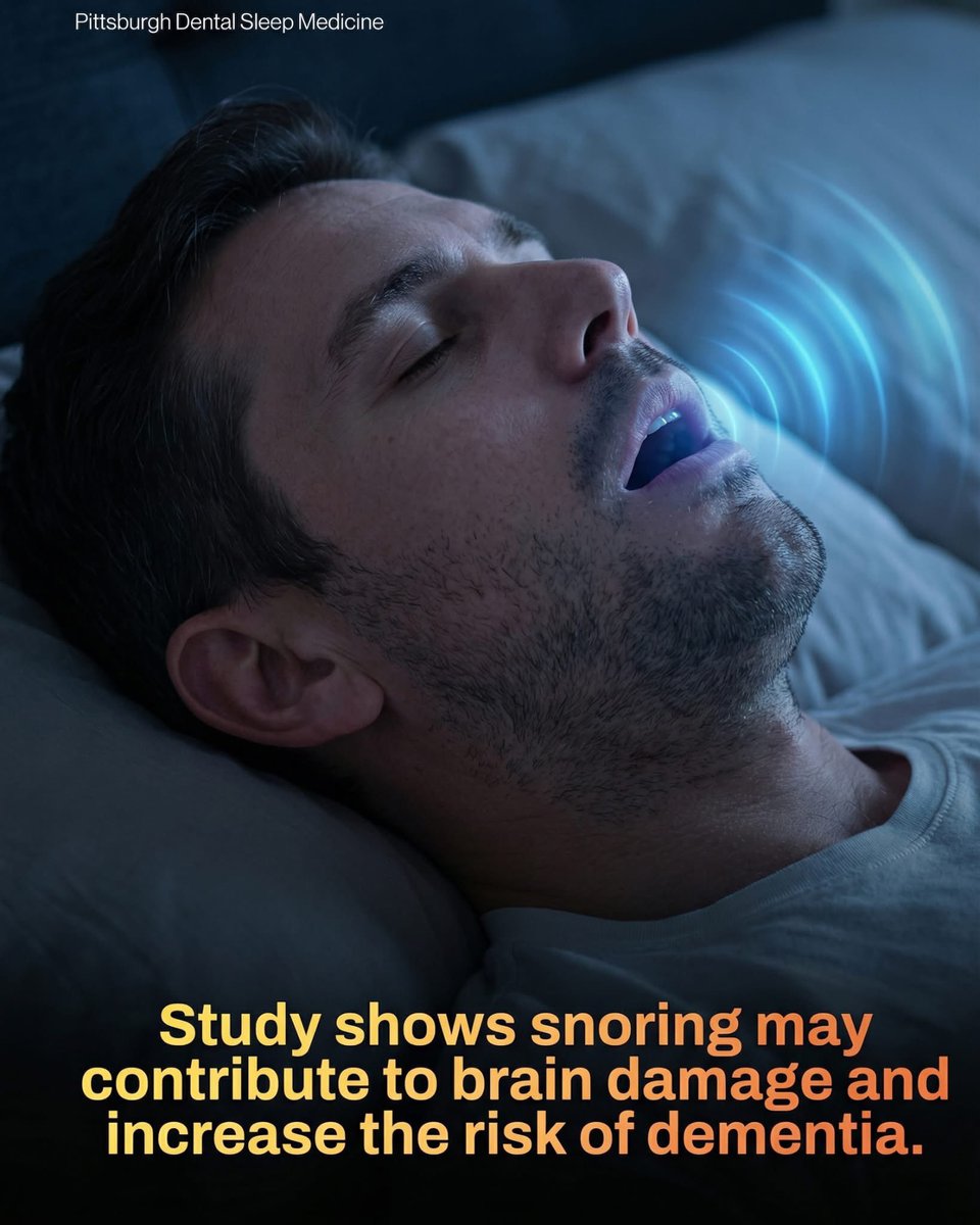 ShiningScience's tweet photo. New research reveals that chronic snoring can cause brain damage — and contribute to dementia.

Loud, persistent snoring is often the primary indicator of Obstructive Sleep Apnea (OSA), a condition where breathing repeatedly stops and starts throughout the night. 

These interruptions cause chronic oxygen deprivation and brain inflammation, leading to vascular damage and memory issues. 

Scientists have found that individuals with severe sleep breathing disorders often show a higher accumulation of beta-amyloid plaques, which are hallmark biological signatures of Alzheimer’s disease. This suggests that the physical strain of poor sleep directly impacts the brain's long-term health and structural integrity.

The relationship between snoring and brain health involves a complex "paradox" as we age. While snoring in mid-life is a significant risk factor, a sudden reduction in snoring in older adults can actually be an early indicator of developing dementia, often tied to weight loss associated with the disease. Fortunately, managing these risks through treatments like CPAP machines can improve oxygen levels and potentially slow cognitive impairment. Experts recommend that those experiencing gasping for air, morning headaches, or extreme daytime fatigue seek medical advice to protect their cognitive future.

source: National Institutes of Health and the Fisher Center for Alzheimer's Research Foundation. (2024). Snoring-Dementia Connections and Sleep Apnea Management.