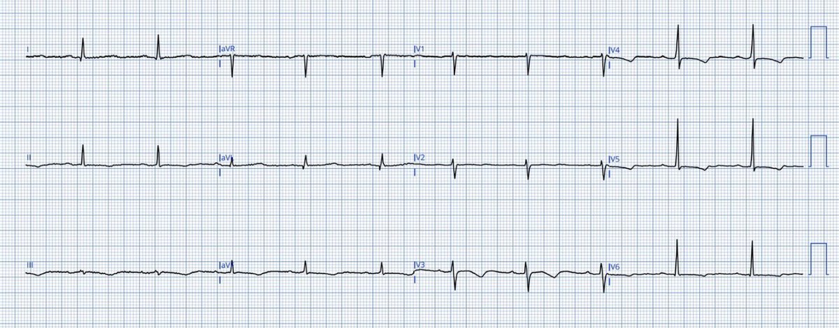 TheECGMedic tweet picture