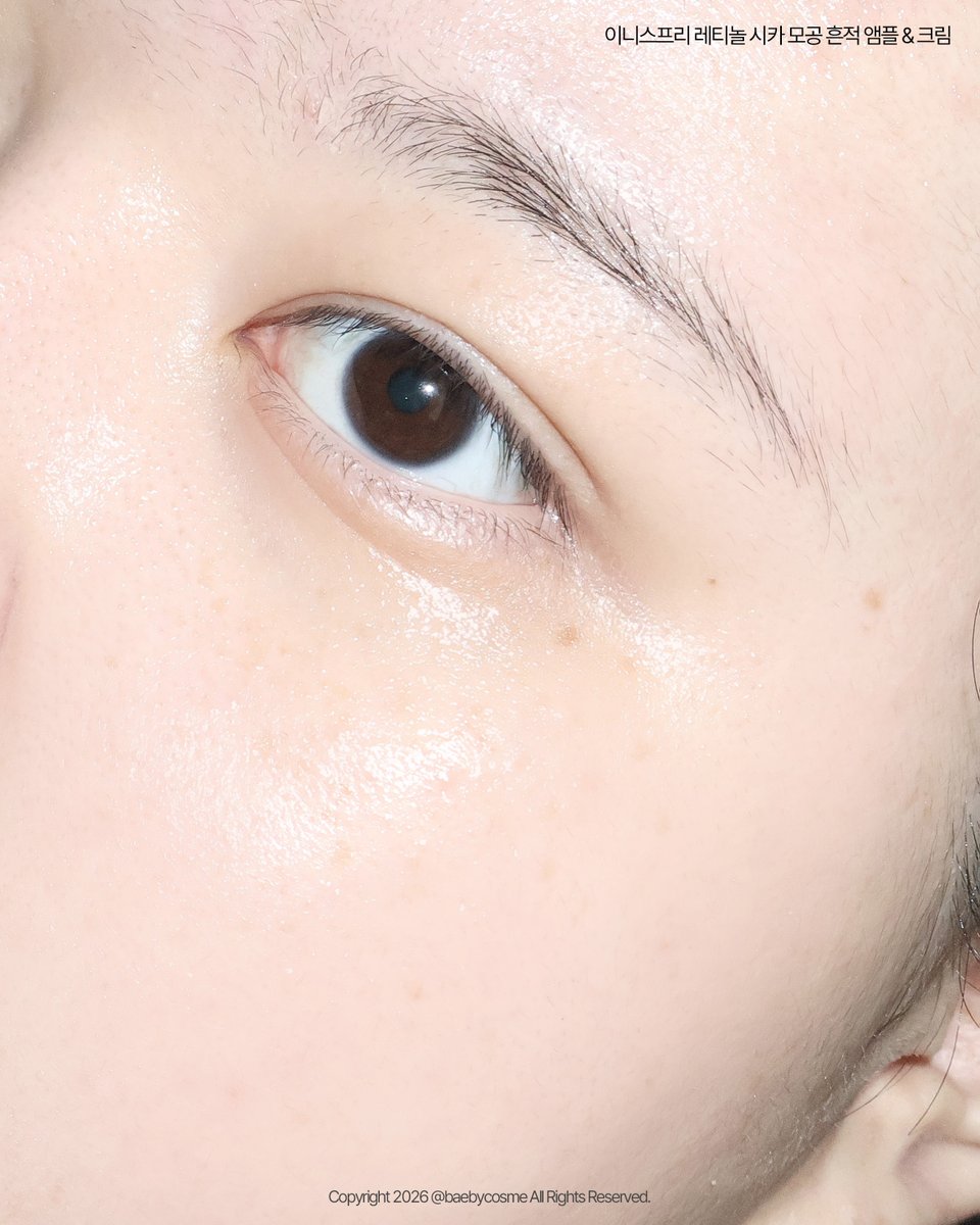 baebycosme's tweet photo. #광고 #RT이벤트 @Innisfree_kr

RT 세 분께 이니스프리 레티놀 시카 모공 흔적 앰플 기획세트 보내드려요✴︎ (당발 7/17)

레티놀 앰플 하면 뭐다? 이니스프리다...
1등¹⁾ 레티놀 시카 앰플이 더 강력하게 돌아왔어요!

모공, 두드러지는 티존, 나비존 울퉁불퉁한게 고민이신 분들은 이니스프리 레티놀 시카 라인 무조건 써보셔야돼

저는 업그레이드 전 버전 앰플부터 몇달째 쭉 써오고 있는데 확실히 요즘은 모공 고민 덜한 느낌!