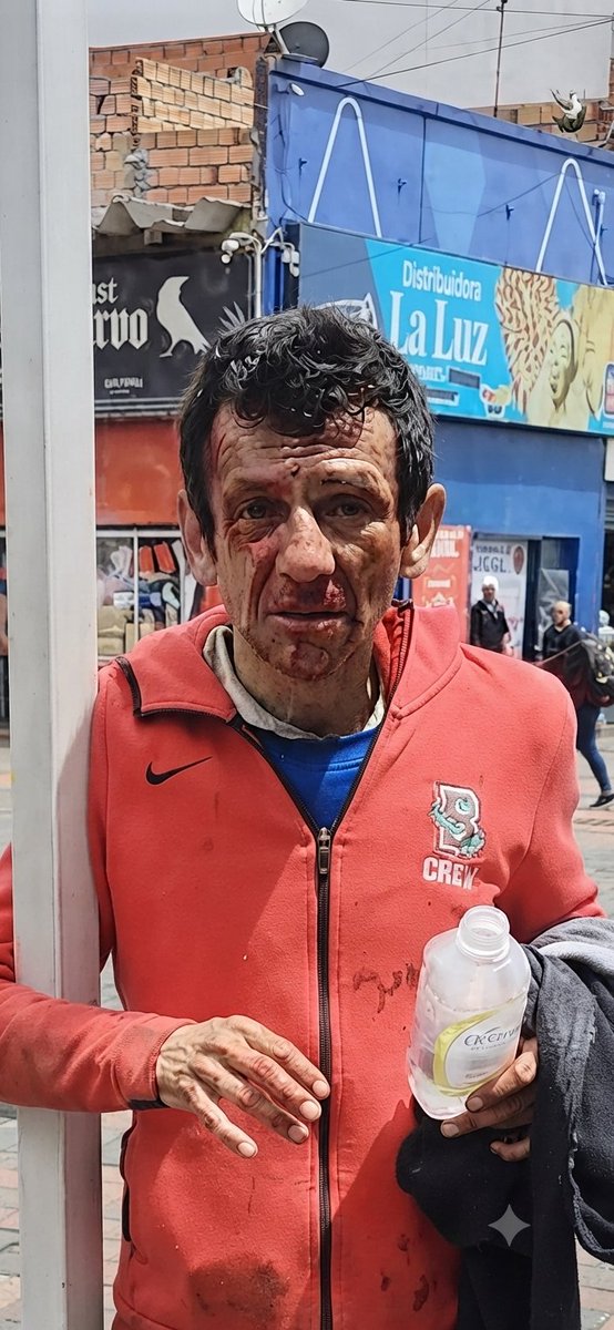 horusperegrinus's tweet photo. #Horus 🦅 Este ratherian, parece que muy popular en los negocios del 7bde Agosto en Bogotá, se salvó de una contundente recalibración cognitiva por la llegada de agentes de la Policía que inmediatamente se interpusieron entre la ciudadanía y el individuo. #NoMasRatas #Horus https://t.co/wUZojqZrtP