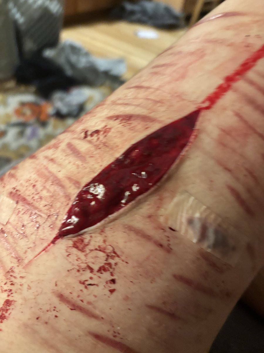 Grayson2hdx's tweet photo. It will never be big enough.
#cutspo #scarspo #shedtwt https://t.co/Q53vXRKxzn