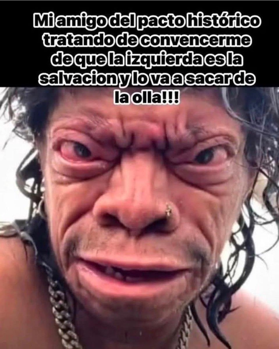 YoyaIm27's tweet photo. @lunadiana0 @elespectador https://t.co/n6MBvgM6Lx