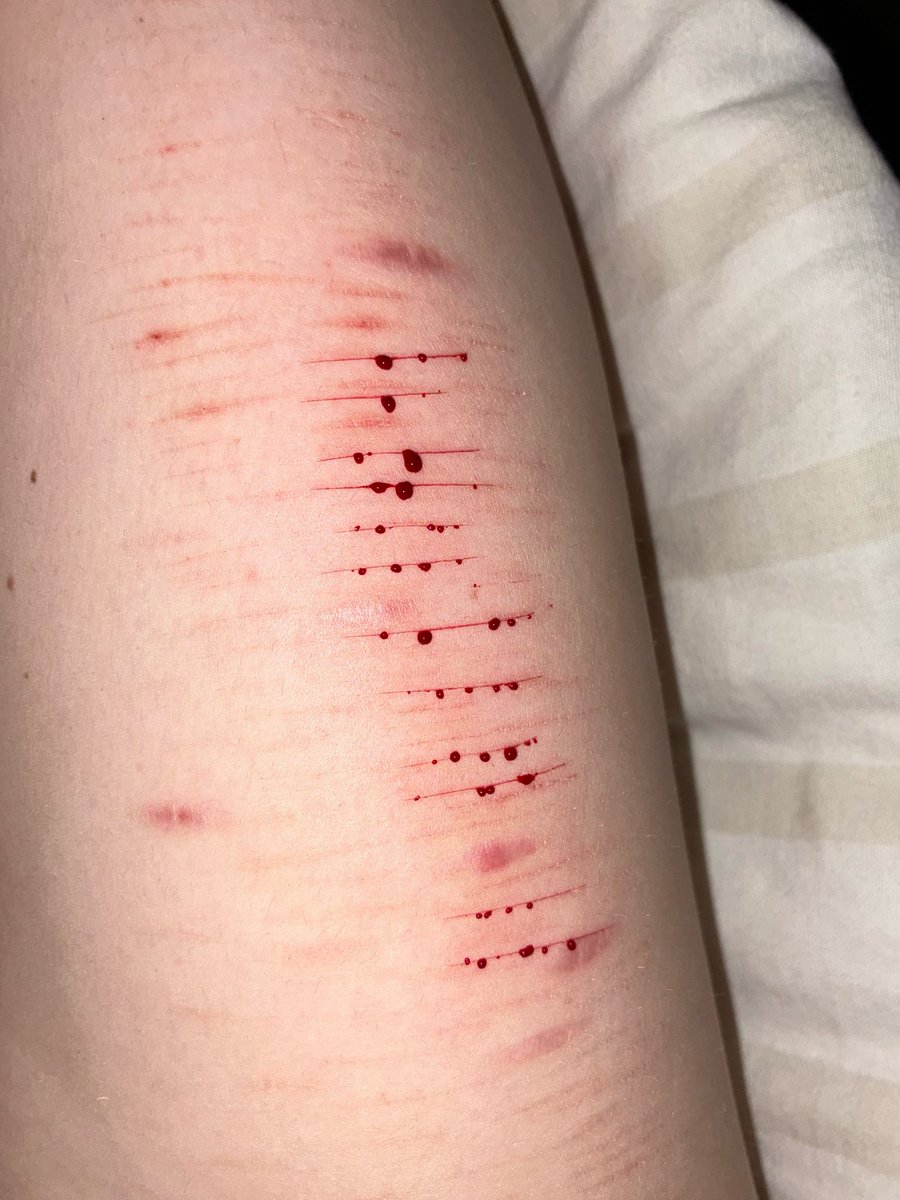 nothing4everX's tweet photo. oo shittings https://t.co/9tanOcfyOY