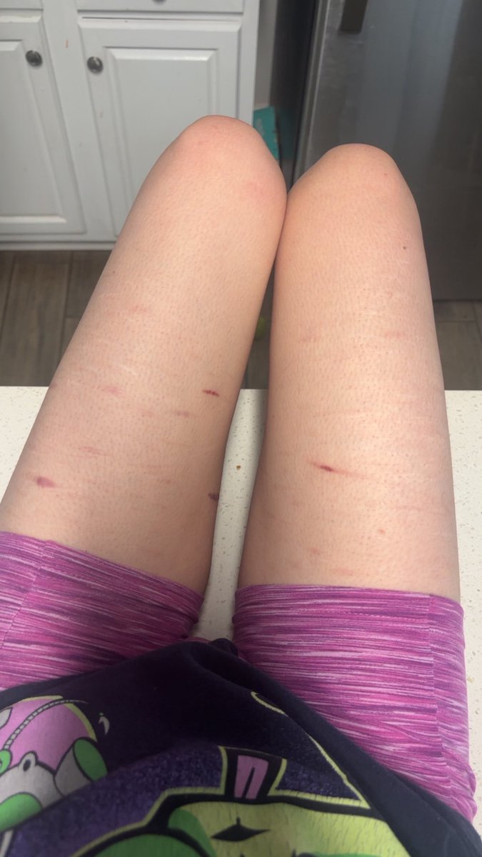 diexrose_'s tweet photo. Holy fuc I missed my body I cannot believe I’m back to atleast this https://t.co/7QFuQCCKjj