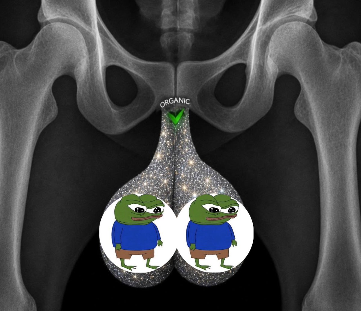 FloxYx100's tweet photo. @ExoqdWeb also bigballs
$PUNK https://t.co/9YlJLYK9iq