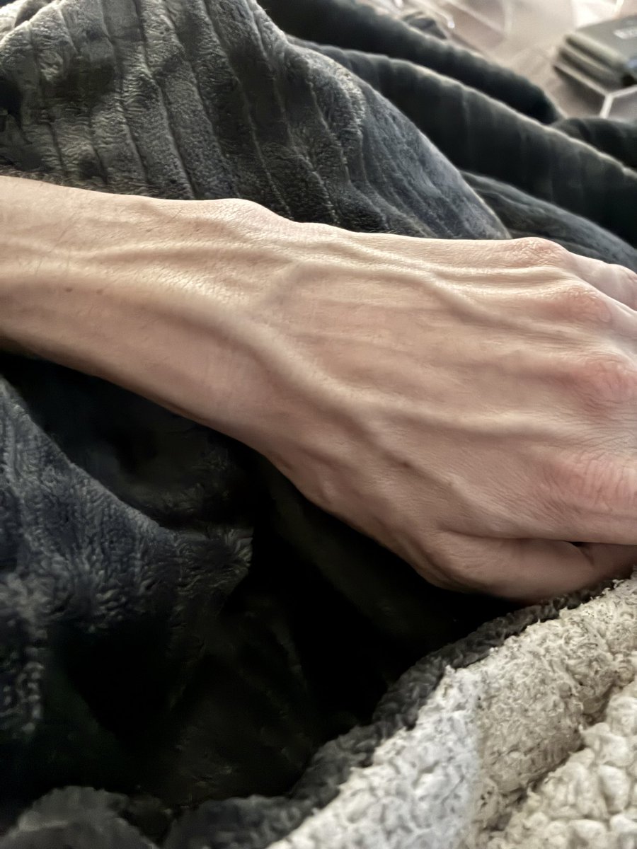 cloudie_pie's tweet photo. I was told that my hands make me look as though I am ninety years old. https://t.co/OVUzylJK1h