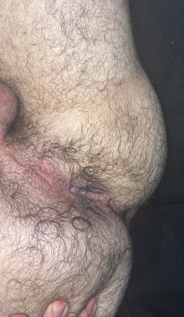 brguyfeet's tweet photo. 🔥 Cuceta https://t.co/Aq2XUh84Gd