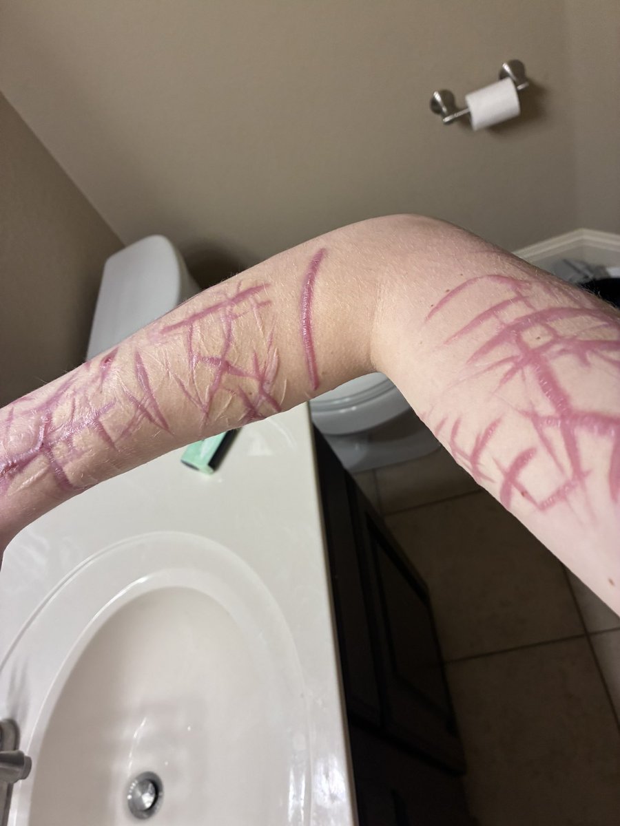 0_DewyRose_0's tweet photo. tw sfx ai generated. is this considered a severe level of sh? (all healed) https://t.co/ZQaCNirjLT