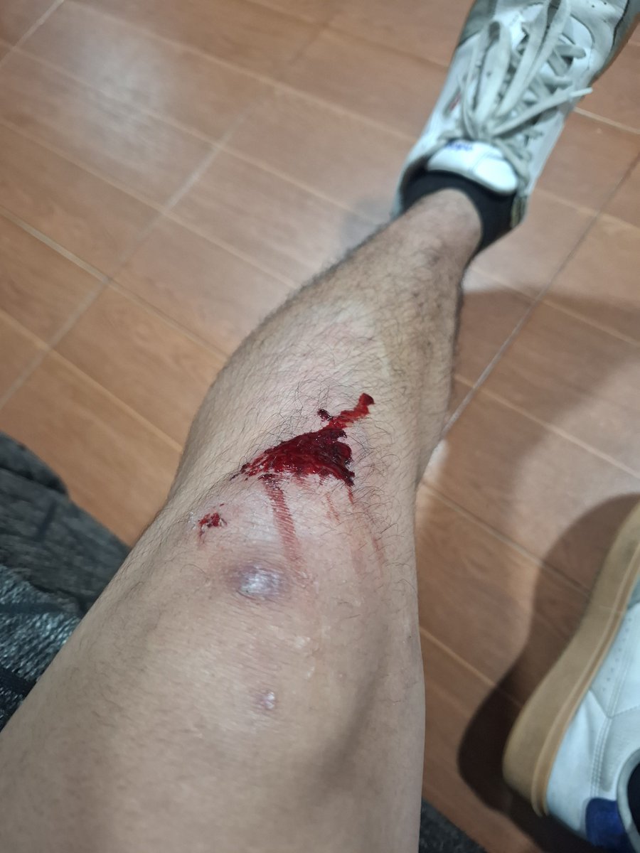 IslaasAR's tweet photo. nada como un buen putazo para recordar que estoy vivo https://t.co/rlu3FTJb3J