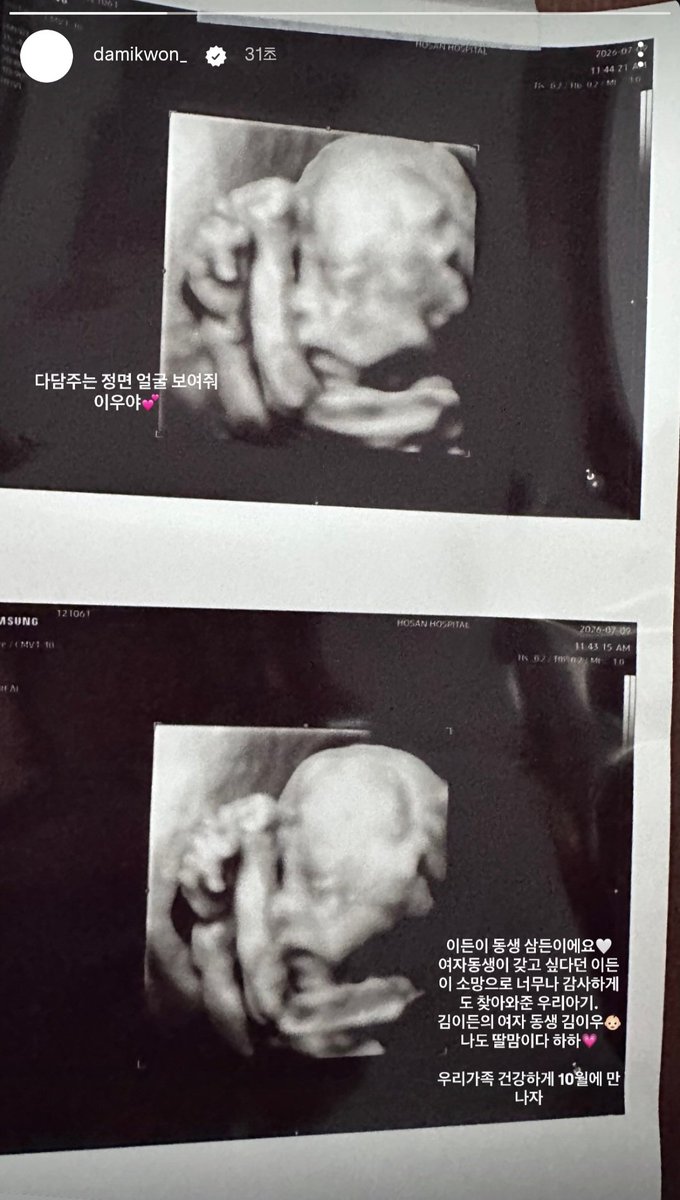 always_bigbang3's tweet photo. 아ㅜ권죵 여자 조카 생긴다 이우래ㅜㅜ축하드립니다🥳🥳🥳 https://t.co/ZDSEma631j