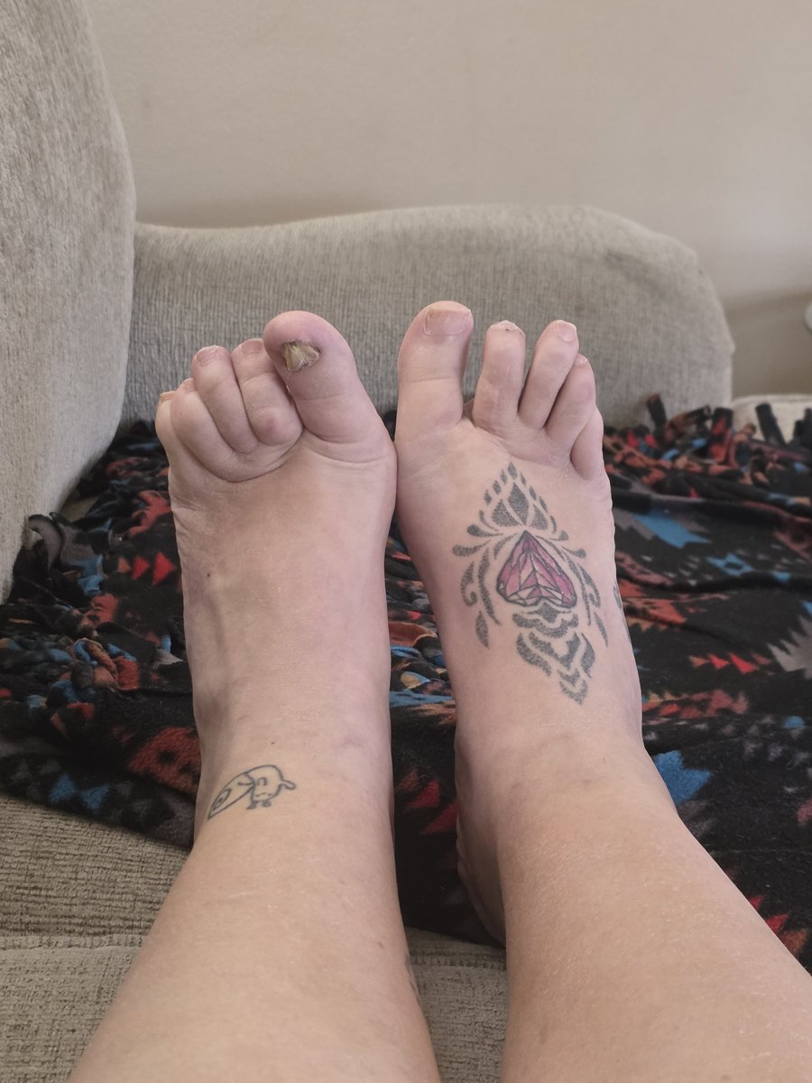 Bigfeetfem13's tweet photo. I know they arent typical piggies but they're what I've got 😕
#feet #feetworshi̇p #footfetısh #footworship #uglytoes #size13shoes #moneylover #foottattoos https://t.co/XzR3aXaU1x