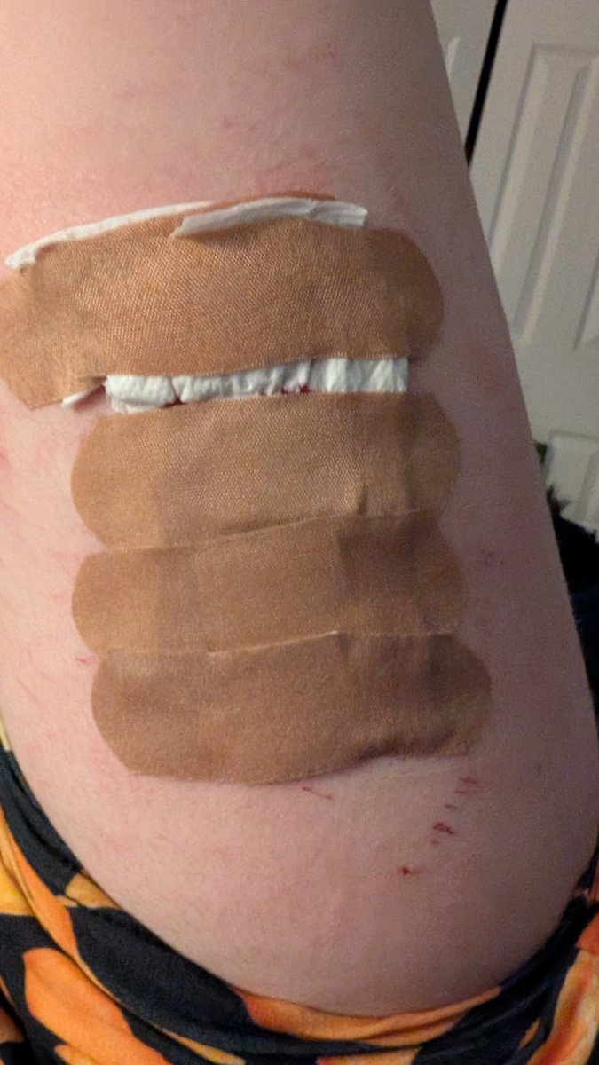 Blake30ml's tweet photo. Baby styros and cat scratches on my fat ass legs plane got cancelled so at my grandparents house tell sat. I could only get my hands on pencil sharpener blades : /
#shedtwt #shhtwt #cuttwt #slittwt #cutspo? https://t.co/vTeuIAZcjy