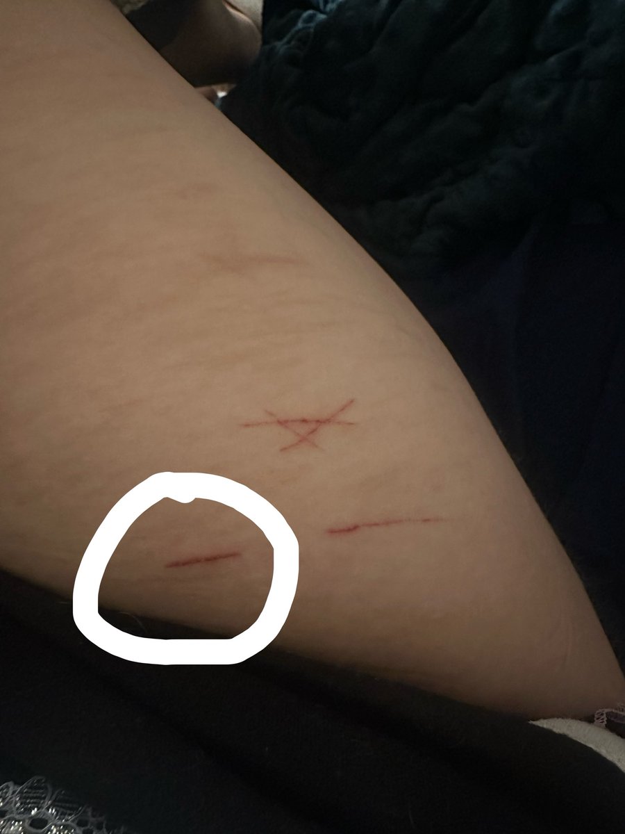 AlexAngelll444's tweet photo. @0rbitttingloona Here’s mine. The one circled was an instant styro https://t.co/zRqy1AFItT