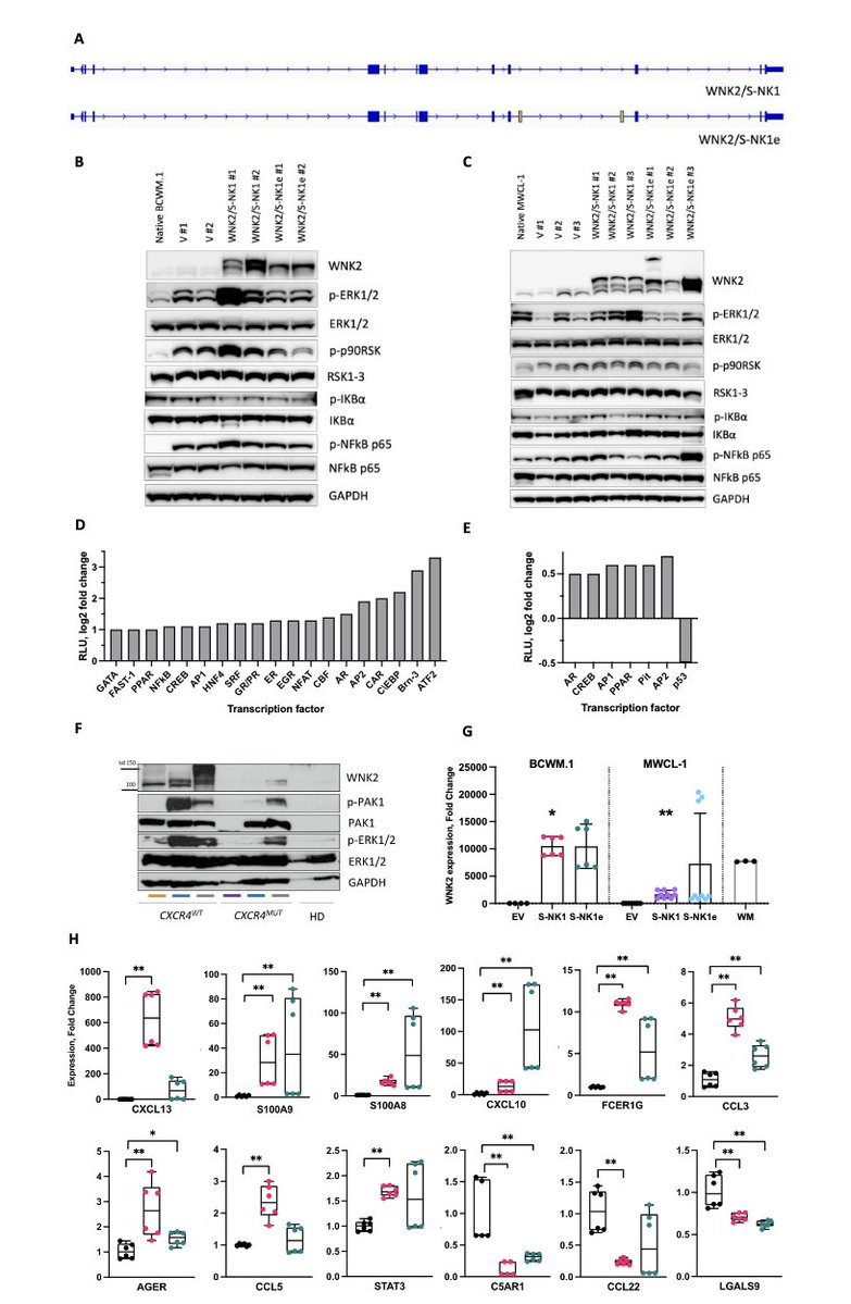 Myeloma_Doc's tweet photo. #Myeloma Paper of the Day: WNK2 oncogenicity revealed by discovery & functional characterization of novel gene isoforms w/ shared aberrant splicing in MYD88-MUT #Waldenström macroglobulinemia; induce pro-inflammatory cascade; activate ERK1/2, NF-κB: https://t.co/eGFOvihK8J. #wmsm https://t.co/1yaNaSMfWz