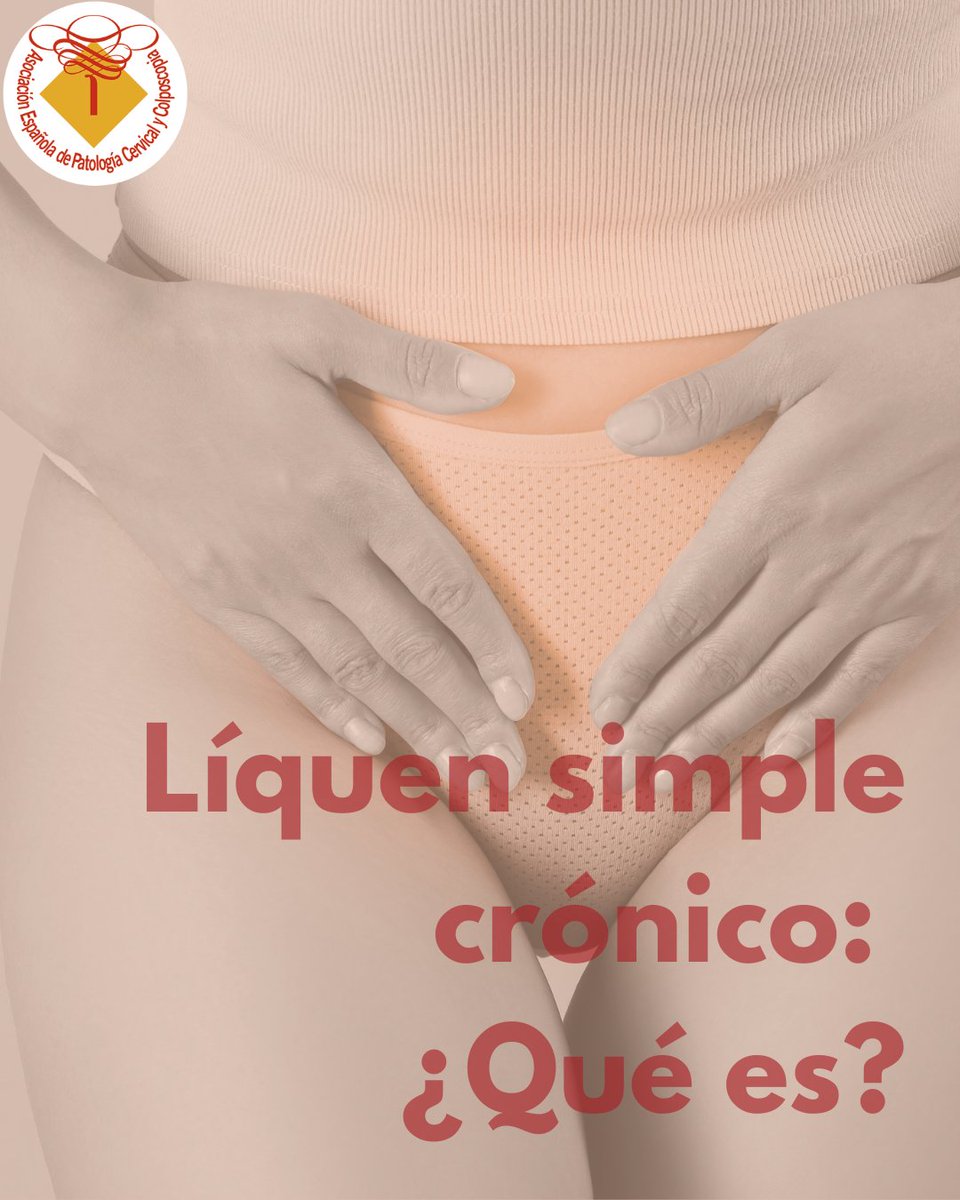aepccolposcopia's tweet photo. 🩺 Líquen simple crónico: ¿qué es?

Te contamos qué es y cómo puede tratarse.

💙 Descúbrelo en este post.

#AEPCC #SaludÍntima #Prevención https://t.co/914D5ATq1Y
