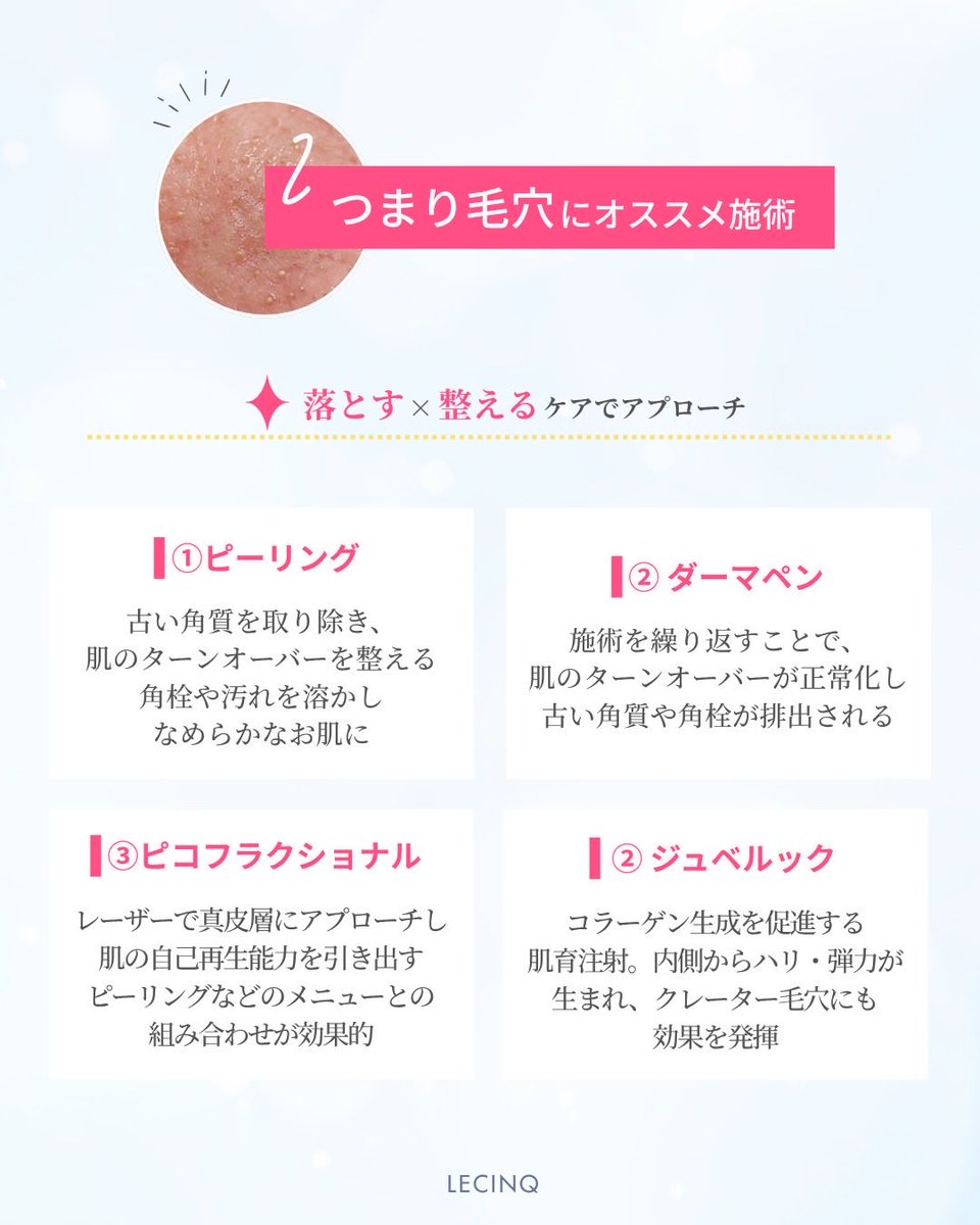 LecinqG's tweet photo. 毛穴治療のタイプ別のお勧めについてです。
タイプによって治療のアプローチが変わります。ただ、毛穴のタイプが複合していることもあります。
1種類の治療だけではなく、複数の治療の組み合わせをお勧めします。 https://t.co/sTAP7wRuM6
