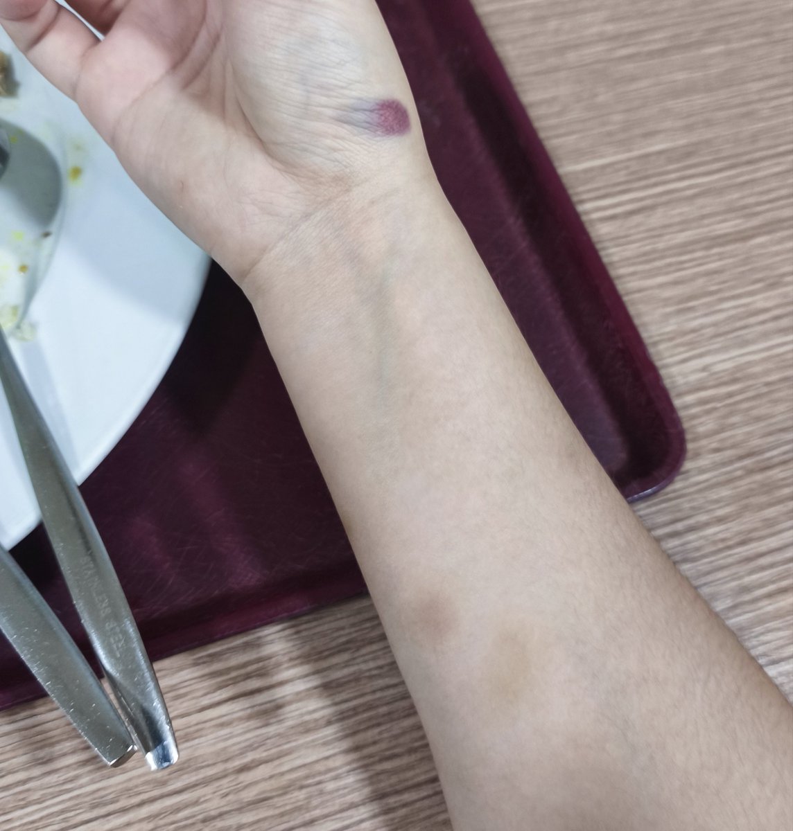 rubyLadyzombie's tweet photo. Its me n my mysterious bruises against the world https://t.co/Nq6JrXQLIt