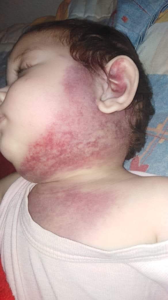 FadiQGaza's tweet photo. Humanity check 😭

︎
︎

︎

︎

︎
︎

︎

︎

︎

we’ll remind you 🥺
︎

︎

︎

︎

︎
︎

︎

︎

︎

︎
︎

︎
︎

︎
︎

︎

︎

︎

︎
︎

︎

︎

︎

that
︎

︎

︎

︎

︎

︎
︎

︎

︎

︎
︎
💔
︎
I desperately need TREATMENT for my baby 👶
https://t.co/UobZ74ba1B https://t.co/U3a4K7eT8Z